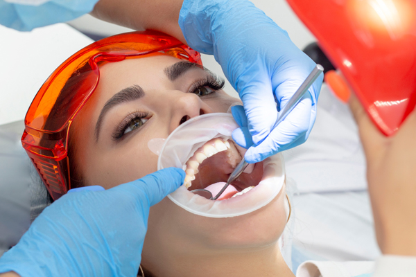 Root Canal Recovery: What To Expect After Undergoing Therapy