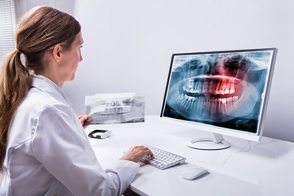 What Does An Endodontist Look For In An X Ray?